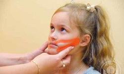 Кинезиологическое тейпирование в логопедии